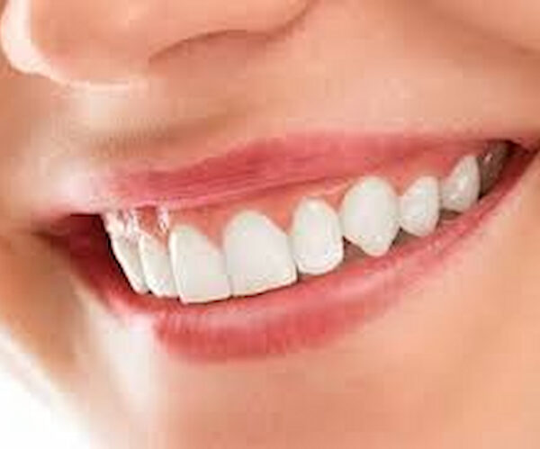 Cosmetic Dentistry