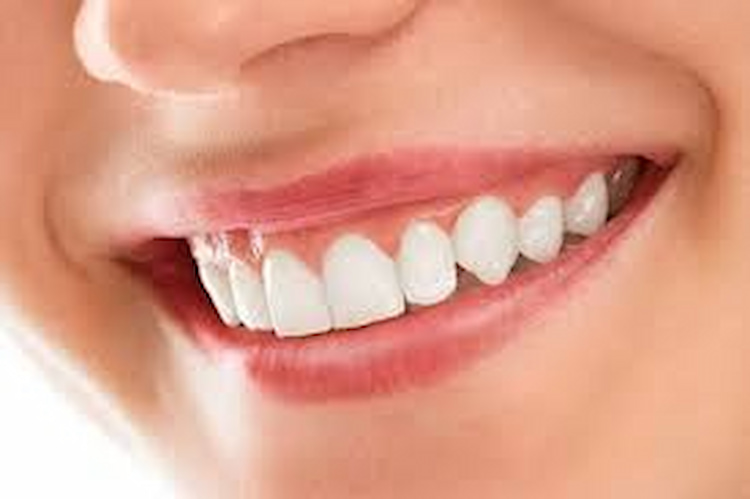 Cosmetic Dentistry