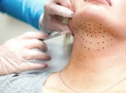 Say Goodbye to Your Double Chin Effective Double Chin Removal Dubai