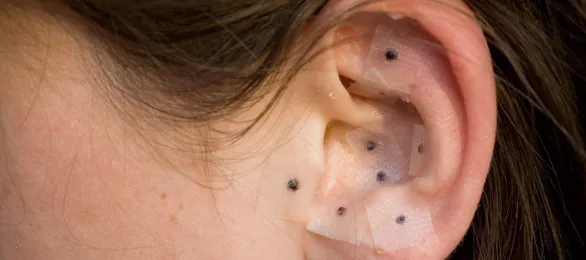 Why Ear Seeding Is Becoming the Latest Holistic Health Trend